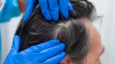 Best Hair Loss Treatment in Mumbai: What You Need to Know