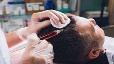 The Best Hair Transplant Clinic in Mumbai: To Get Results That Look Natural